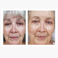 Before & After of woman with brightened complexion and reduced redness